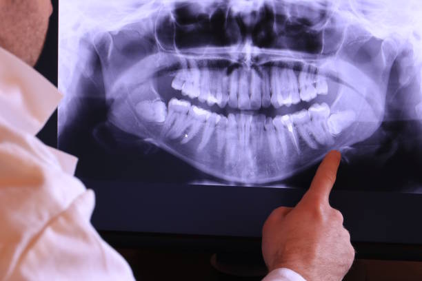 Best Emergency Denture Repair in Boulevard Gardens, FL