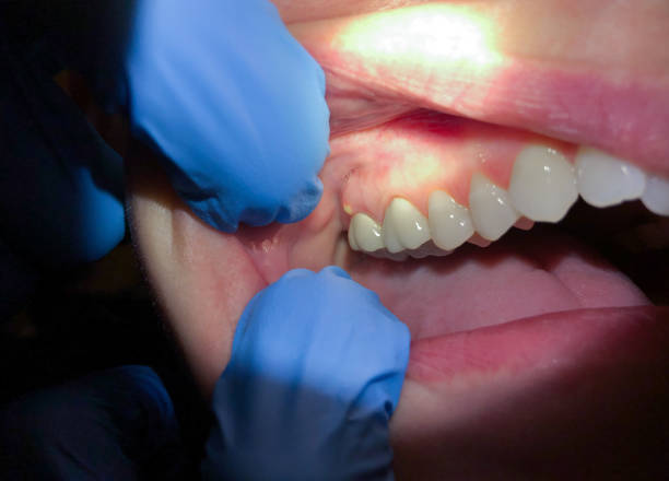 Best Emergency Orthodontic Repairs in Boulevard Gardens, FL