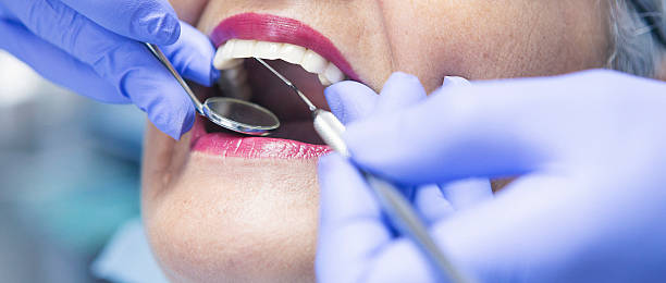 Best Emergency Dental Care for Sports Injuries in Boulevard Gardens, FL